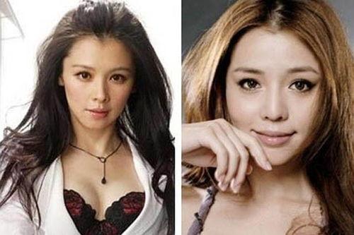 整容雙胞胎女明星,揭秘整容雙胞胎女明星的美麗蛻變之路