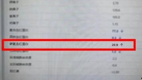 頭條抽獎平臺名單,驚喜大獎等你來拿！”